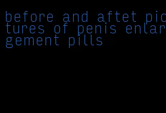 before and aftet pictures of penis enlargement pills