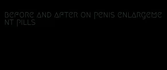 before and after on penis enlargement pills