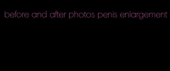 before and after photos penis enlargement
