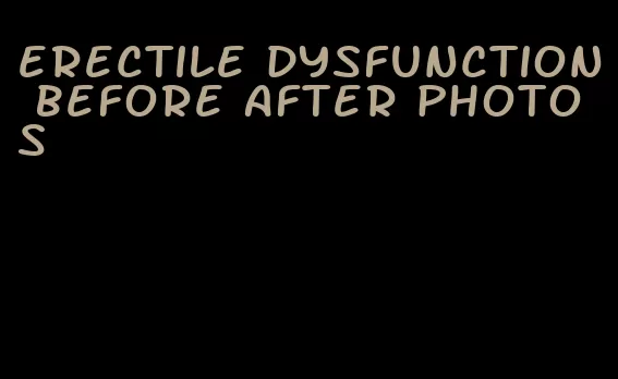 erectile dysfunction before after photos