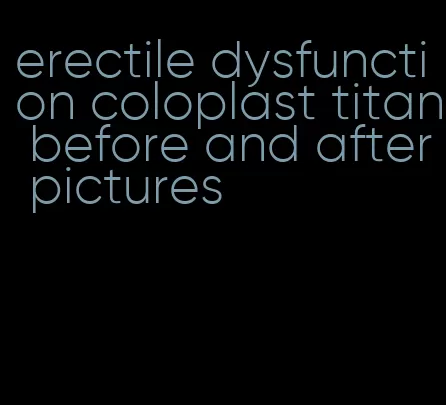 erectile dysfunction coloplast titan before and after pictures