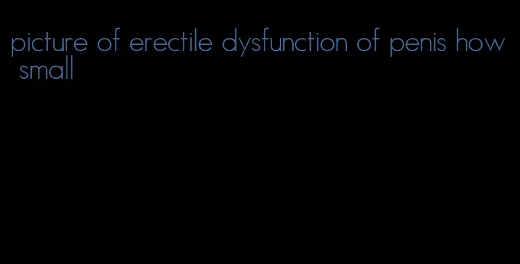 picture of erectile dysfunction of penis how small