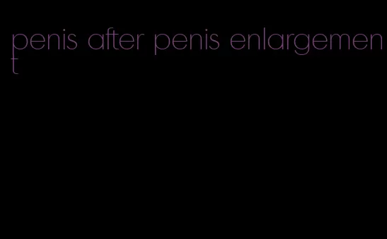penis after penis enlargement