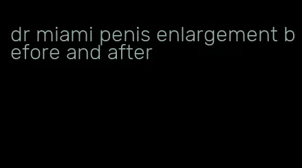 dr miami penis enlargement before and after