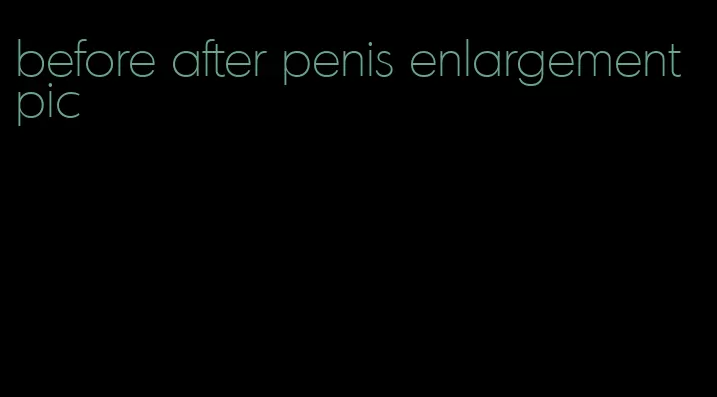before after penis enlargement pic