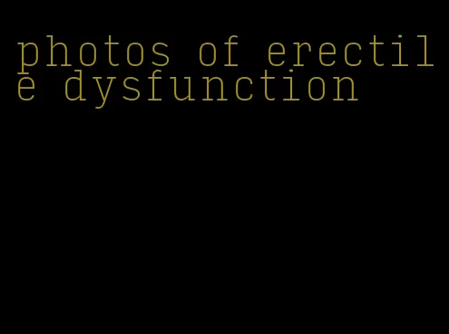 photos of erectile dysfunction