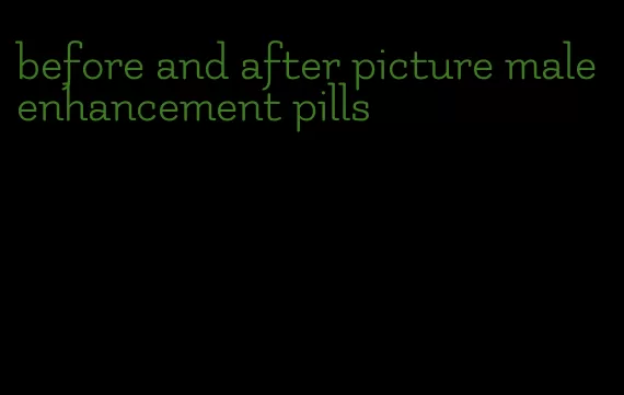 before and after picture male enhancement pills