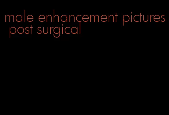 male enhancement pictures post surgical