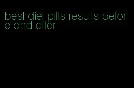 best diet pills results before and after
