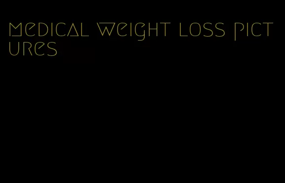 medical weight loss pictures
