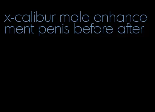 x-calibur male enhancement penis before after